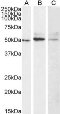 Western Blot: MMP-14/MT1-MMP Antibody (LEM-2/15)Azide and BSA Free [NBP3-09002]