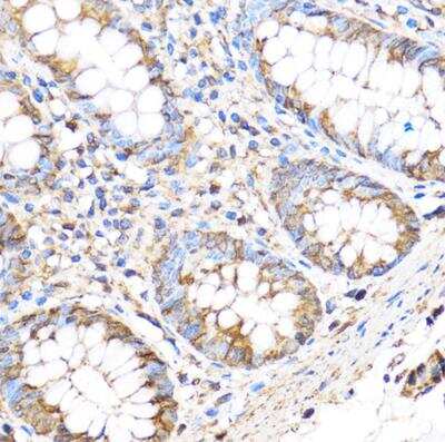 Immunohistochemistry-Paraffin: MMP-17 Antibody - Azide and BSA Free [NBP2-94898]
