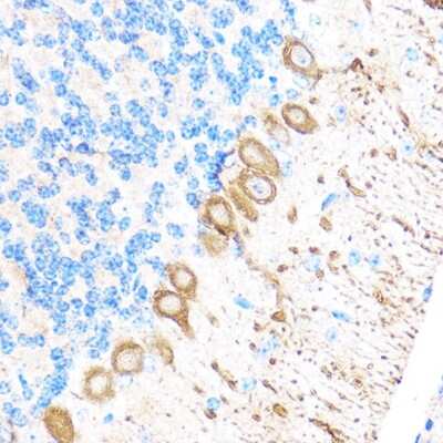 Immunohistochemistry-Paraffin: MMP-17 Antibody - Azide and BSA Free [NBP2-94898]