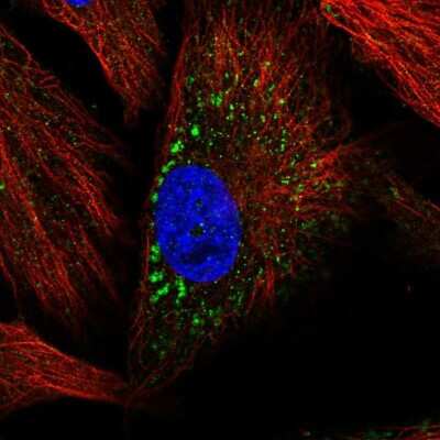 Immunocytochemistry/ Immunofluorescence: MMP-19 Antibody [NBP2-57845]