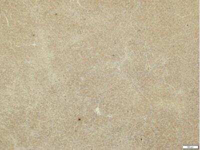 Immunohistochemistry-Paraffin: MMP-19 Antibody [NBP2-17311]
