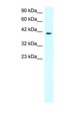 Western Blot: MMP-19 Antibody [NBP1-57092]