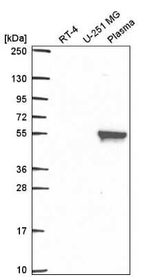 Western Blot: MMP-19 Antibody [NBP2-57845]