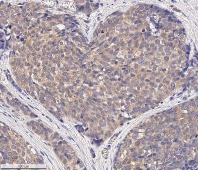 Immunohistochemistry-Paraffin: MMP-2 Antibody (2C1) - (Pro and Active) - BSA Free [NB200-113]