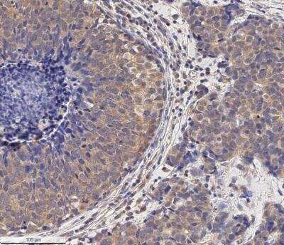 Immunohistochemistry-Paraffin: MMP-2 Antibody (2C1) - (Pro and Active) - BSA Free [NB200-113]
