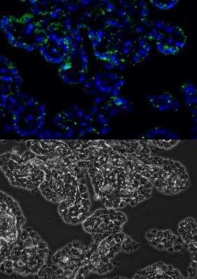 Immunohistochemistry-Paraffin: MMP-2 Antibody (2C1) - (Pro and Active) - BSA Free [NB200-113]