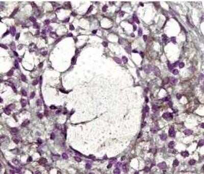 Immunohistochemistry: MMP-2 Antibody (8B4) - (Pro and Active) - Azide and BSA Free [NBP2-80854]