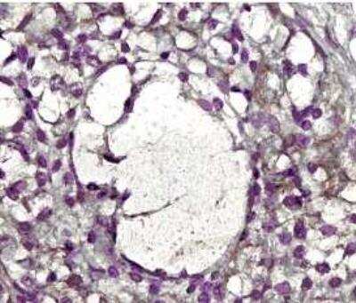 Immunohistochemistry-Paraffin: MMP-2 Antibody (8B4) - (Pro and Active) - BSA Free [NB200-114]