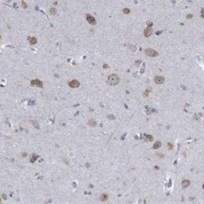 Immunohistochemistry-Paraffin: MMP-24/MT5-MMP Antibody [NBP3-17274]