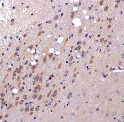 Immunohistochemistry-Paraffin: MMP-3 Antibody - BSA Free [NB100-91878]