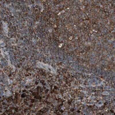 Immunohistochemistry-Paraffin: MMP-3 Antibody [NBP1-82431]