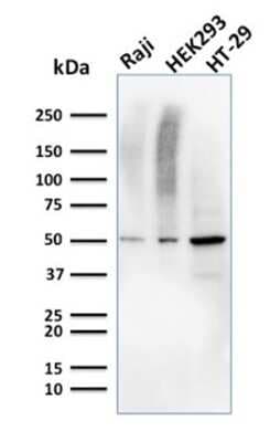 Western Blot: MMP-3 Antibody (MMP3/2655) [NBP2-79730]