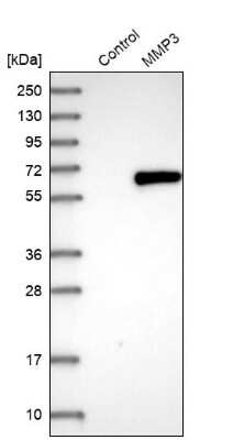 Western Blot: MMP-3 Antibody [NBP1-82431]
