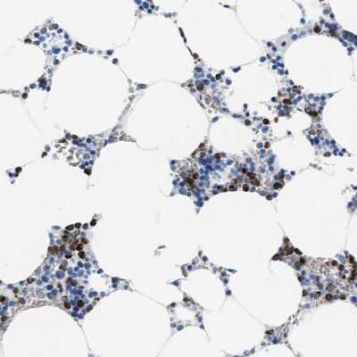 Immunohistochemistry-Paraffin: MMP-8 Antibody [NBP1-85577]