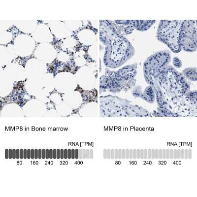 Immunohistochemistry-Paraffin: MMP-8 Antibody [NBP1-85577]