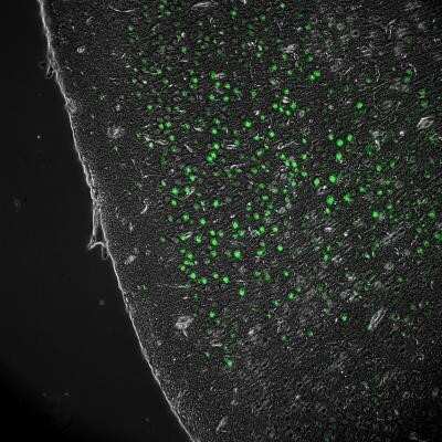 Immunohistochemistry: MMP-9 Antibody (4A3) [NBP2-13173]