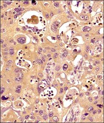 Immunohistochemistry-Paraffin: MMP-9 Antibody (4A3) [NBP2-13173]