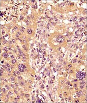Immunohistochemistry-Paraffin: MMP-9 Antibody (4A3) [NBP2-13173]