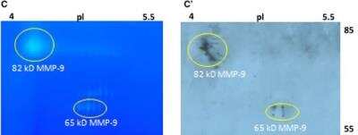 Western Blot: MMP-9 Antibody (4A3) [NBP2-13173]