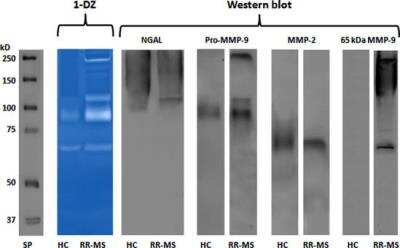 Western Blot: MMP-9 Antibody (4A3) [NBP2-13173]
