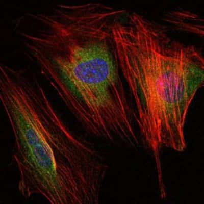Immunocytochemistry/ Immunofluorescence: MMP-9 Antibody (5G3) - BSA Free [NBP2-22181]