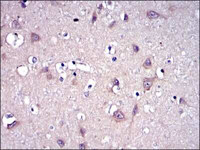 Immunohistochemistry-Paraffin: MMP-9 Antibody (5G3) - BSA Free [NBP2-22181]