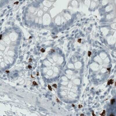 Immunohistochemistry: MMP-9 Antibody (CL0538) [NBP2-52948]