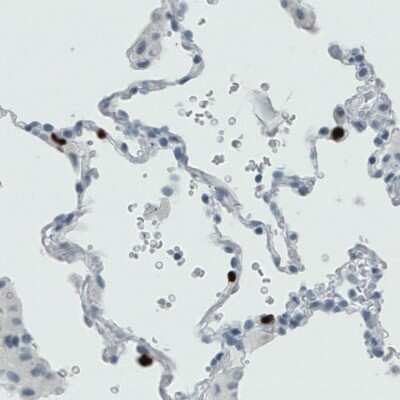 Immunohistochemistry-Paraffin: MMP-9 Antibody (CL0538) [NBP2-52948]