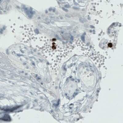 Immunohistochemistry-Paraffin: MMP-9 Antibody (CL0538) [NBP2-52948]