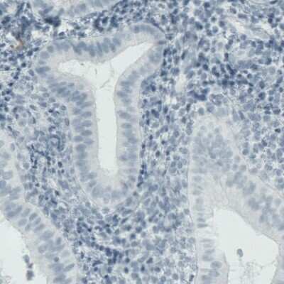 Immunohistochemistry-Paraffin: MMP-9 Antibody (CL0538) [NBP2-52948]