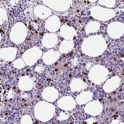 Immunohistochemistry-Paraffin: MMP-9 Antibody [NBP2-39011]