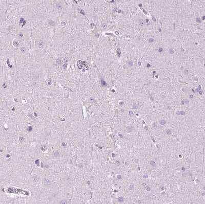 Immunohistochemistry-Paraffin: MMP-9 Antibody [NBP2-39011]