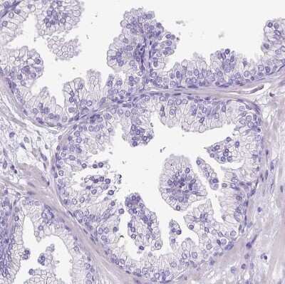 Immunohistochemistry-Paraffin: MMP-9 Antibody [NBP2-39011]