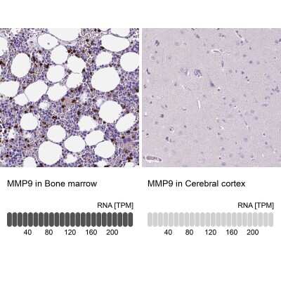 Immunohistochemistry-Paraffin: MMP-9 Antibody [NBP2-39011]