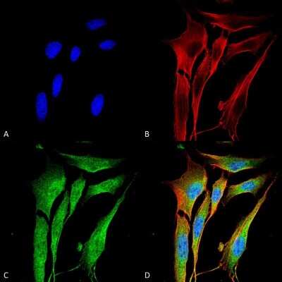Immunocytochemistry/ Immunofluorescence: MMP-9 Antibody (S51-82) [NBP2-59699]