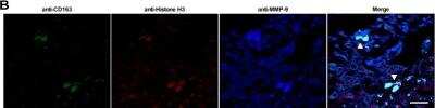 Immunocytochemistry/ Immunofluorescence: MMP-9 Antibody (S51-82) [NBP2-59699]