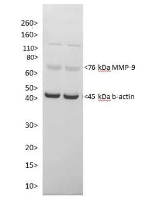 Western Blot: MMP-9 AntibodyBSA Free [NBP1-57940]