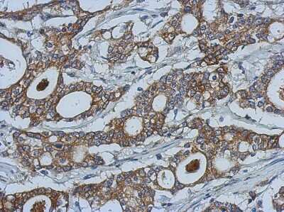 Immunohistochemistry-Paraffin: MMP-10 Antibody [NBP2-17309]