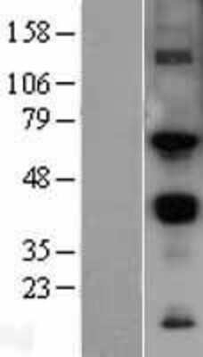 Western Blot: MMP-14/MT1-MMP Overexpression Lysate [NBL1-13153]
