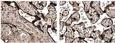 Immunohistochemistry-Paraffin: MMP-15/MT2-MMP Antibody (MM0028-5D11) - Azide and BSA Free [NB110-60994]
