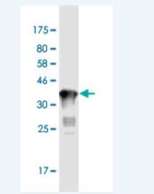 Western Blot: MMP21 Antibody (2F10) [H00118856-M01-100ug]