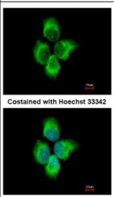 Immunocytochemistry/ Immunofluorescence: MMP-8 Antibody [NBP2-17316]