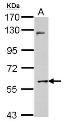Western Blot: MMP-8 Antibody [NBP2-17316]