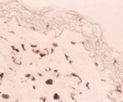 Immunohistochemistry: MMR/CD206/Mannose Receptor Antibody (122D2.08) [DDX0380P-100]