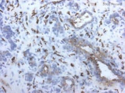 Immunohistochemistry-Frozen: MMR/CD206/Mannose Receptor Antibody (15-2) [NB600-1415]
