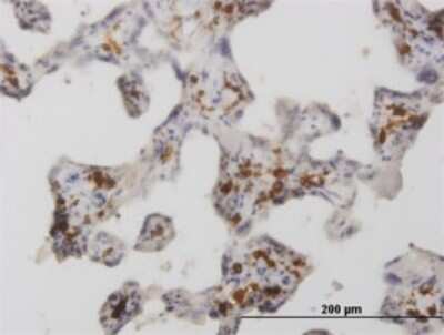 Immunohistochemistry-Paraffin: MMR/CD206/Mannose Receptor Antibody (5C11) [H00004360-M02]