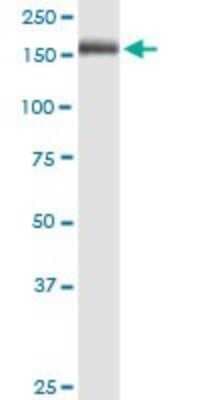 Western Blot: MMR/CD206/Mannose Receptor Antibody (5C11) [H00004360-M02]