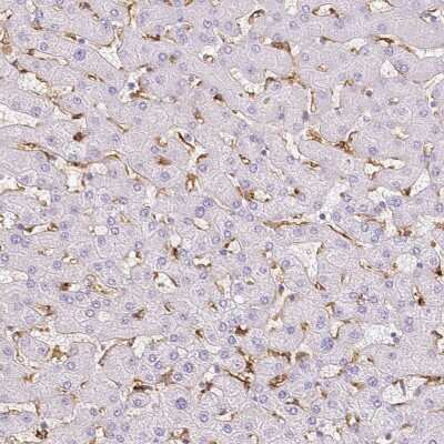 Immunohistochemistry-Paraffin: MMR/CD206/Mannose Receptor Antibody [NBP1-90020]