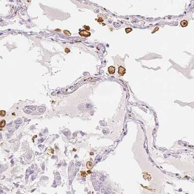 Immunohistochemistry-Paraffin: MMR/CD206/Mannose Receptor Antibody [NBP1-90020]
