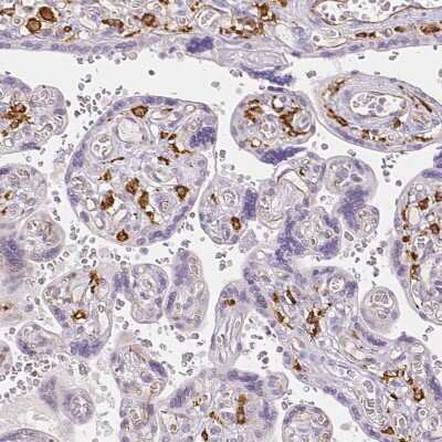 Immunohistochemistry-Paraffin: MMR/CD206/Mannose Receptor Antibody [NBP1-90020]